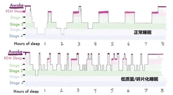 睡够八小时照旧巨累! 大宗因为这个原因